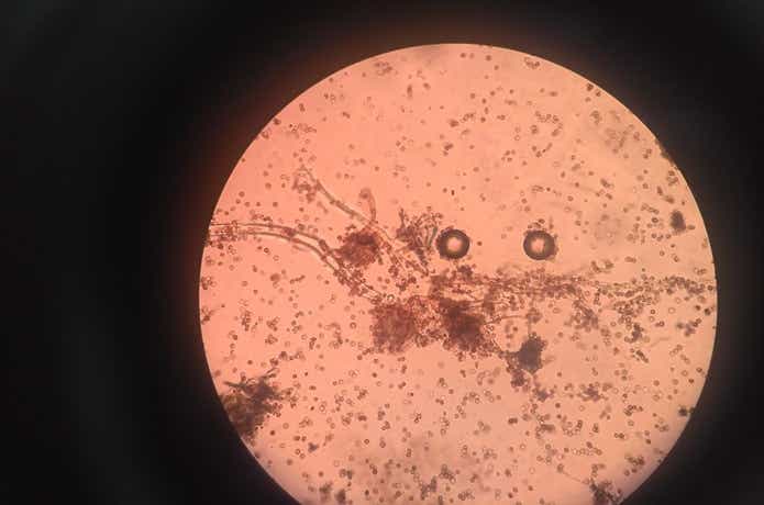 顕微鏡で覗く微生物