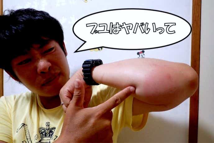 ブヨに刺された
