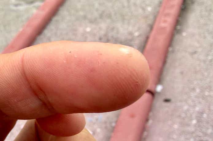 豆ができた指先